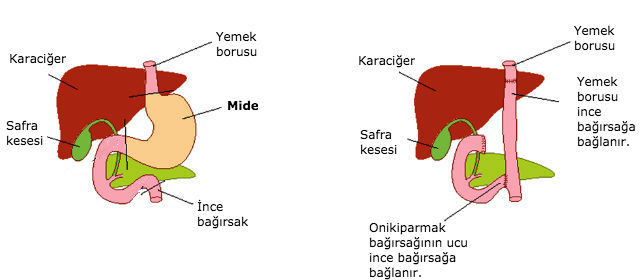 insan_midesiz_yasayabilir_mi_03-min.jpg